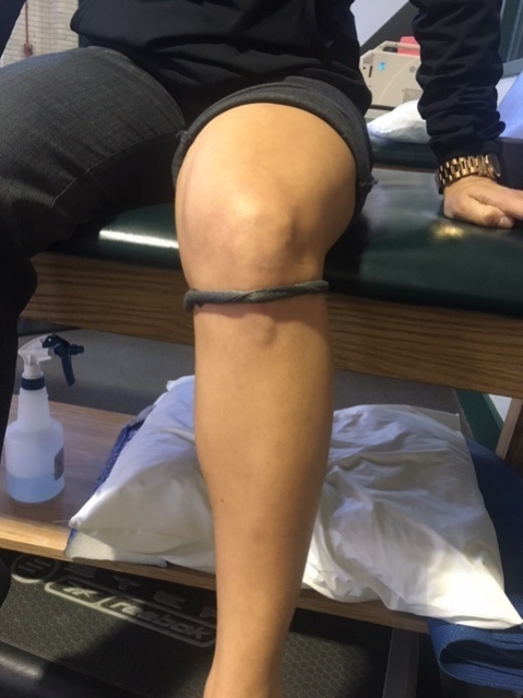 Jumpers Knee – Ortho Rhode Island