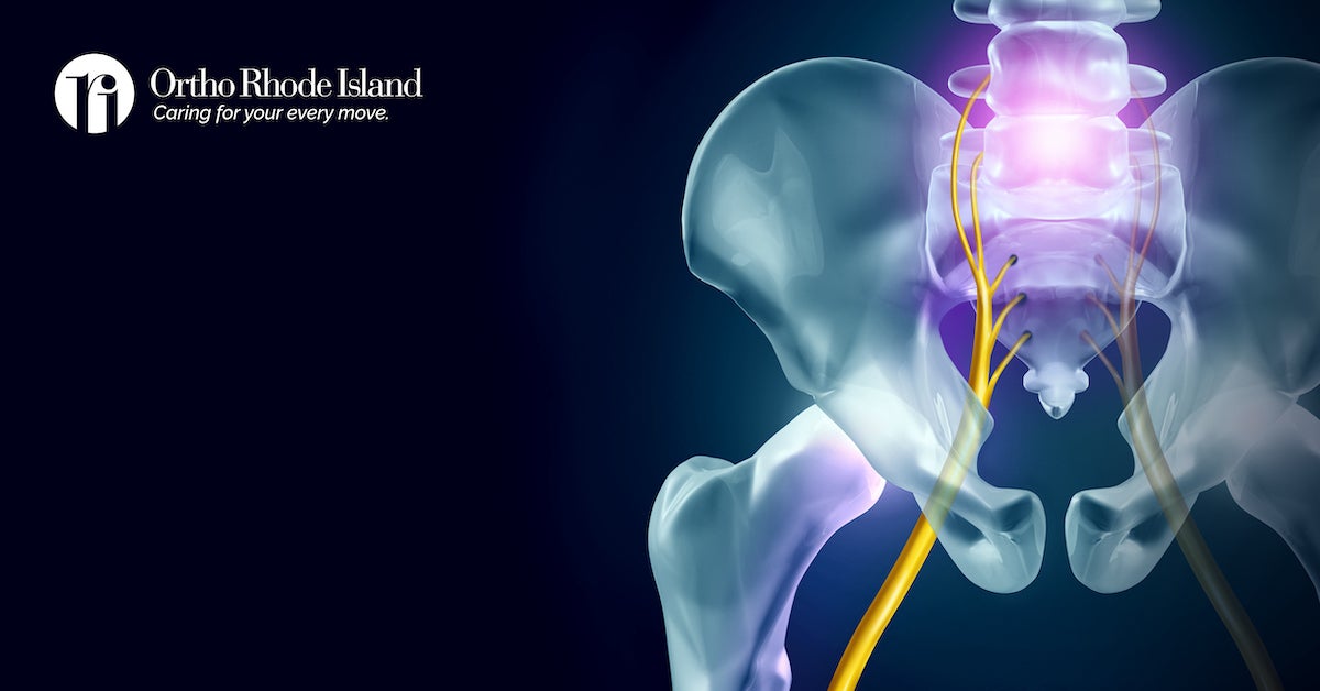 Sciatica – Ortho Rhode Island