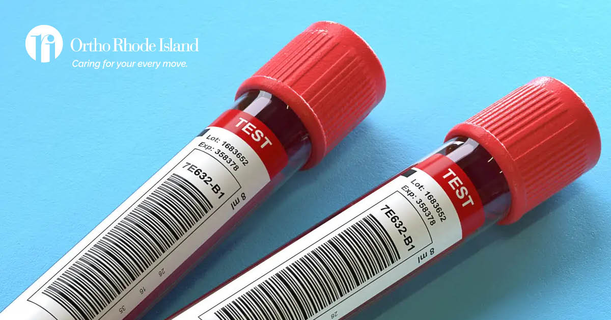Laboratory Tests for Arthritis Key FACTORS to Look For Ortho Rhode