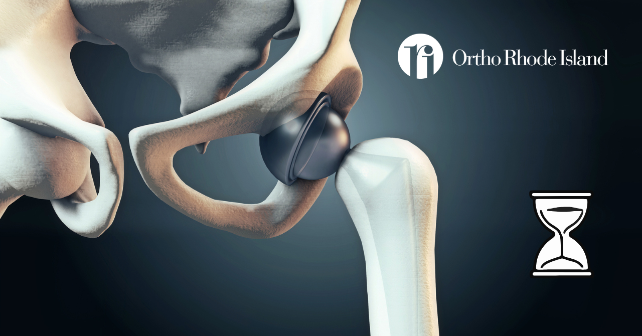 What Patients Ask: How Long Does My Hip Replacement Last? – Ortho Rhode ...